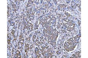IHC analysis of SUCLG2 using anti-SUCLG2 antibody (ABIN7601694). (SUCLG2 anticorps  (AA 42-424))