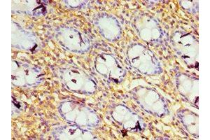 Immunohistochemistry of paraffin-embedded human colon tissue using ABIN7156649 at dilution of 1:100 (GBP1 anticorps  (AA 383-592))