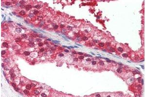 anti-Ubiquilin 1 (UBQLN1) (Internal Region) antibody