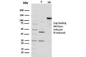 SDS-PAGE Analysis Purified HER-2 Mouse Monoclonal Antibody (ERBB2/3092). (ErbB2/Her2 anticorps  (AA 311-462))