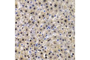 Immunohistochemistry of paraffin-embedded Rat liver using KPNA4 antibody at dilution of 1:100 (x400 lens).