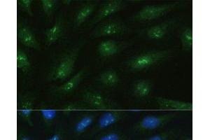 Immunofluorescence analysis of U2OS cells using RAD50 Polyclonal Antibody at dilution of 1:100.