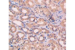 IHC-P analysis of kidney tissue, with DAB staining. (Complement Factor B anticorps  (AA 35-160))