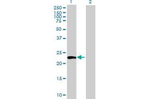 Western Blot analysis of ATG12 expression in transfected 293T cell line by ATG12 MaxPab polyclonal antibody. (ATG12 anticorps  (AA 1-187))
