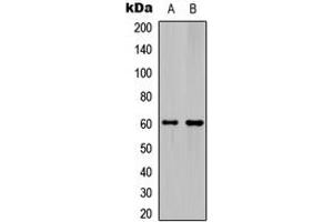Western blot analysis of Ephrin B1/2 expression in HeLa (A), mouse hippocampus (B) whole cell lysates. (Ephrin B1 anticorps  (C-Term))