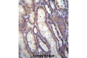 Immunohistochemistry (IHC) image for anti-Forkhead Box A2 (FOXA2) antibody (ABIN2996501)