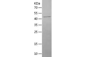 Western Blotting (WB) image for Acetylcholine Receptor Subunit alpha (CHRNA1) (AA 21-255) protein (His-IF2DI Tag) (ABIN7121645)