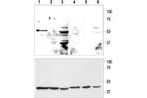 Western blot analysis of KCNK9 in rat cerebellum (lanes 1, 4), human mammary gland MCF-10A (lanes 2, 5) and MCF-7 (lanes 3, 6) cell lysates (upper panel):  - 1-3. (KCNK9 anticorps  (Extracellular, P1 Loop))