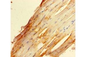 Immunohistochemistry of paraffin-embedded human skeletal muscle tissue using ABIN7176020 at dilution of 1:100 (ZBED1 anticorps  (AA 1-210))