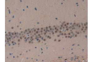 Detection of ND5 in Rat Brain Tissue using Polyclonal Antibody to NADH Dehydrogenase 5 (ND5)