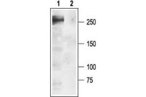 Western blot analysis of rat brain membranes: - 1. (SCN1A anticorps  (Intracellular))