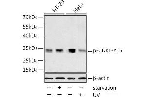 Western blot analysis of extracts of HT-29 and HeLa cells using Phospho-CDK1(Y15) Polyclonal Antibody at dilution of 1:1000. (CDK1 anticorps  (pTyr15))