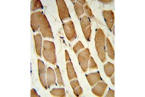 anti-SMAD Family Member 4 (SMAD4) (AA 400-428), (C-Term) antibody