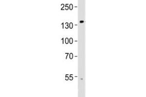 Western blot analysis of lysate from human brain tissue using TRPM8 antibody at 1:1000.