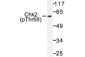 Image no. 1 for anti-Checkpoint Kinase 2 (CHEK2) (pThr68) antibody (ABIN317991) (CHEK2 anticorps  (pThr68))