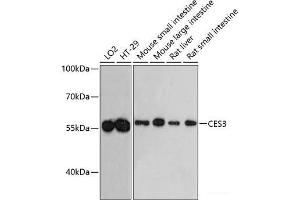 Western blot analysis of extracts of various cell lines using CES3 Polyclonal Antibody at dilution of 1:3000. (CES3 anticorps)