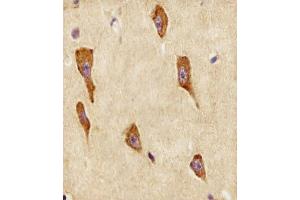 (ABIN6243817 and ABIN6578505) staining GNG12 in human brain tissue sections by Immunohistochemistry (IHC-P - paraformaldehyde-fixed, paraffin-embedded sections).