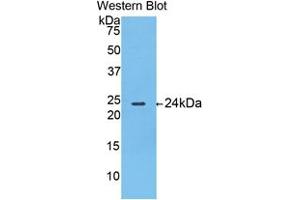 Western blot analysis of the recombinant protein. (Thymidine Phosphorylase anticorps  (AA 38-247))