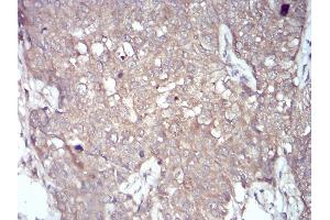 Immunohistochemistry (IHC) image for anti-NADPH Oxidase 4 (NOX4) (AA 210-310) antibody (ABIN5872374) (NADPH Oxidase 4 anticorps  (AA 210-310))