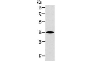 Western Blotting (WB) image for anti-Homeobox D13 (HOXD13) antibody (ABIN5961464)