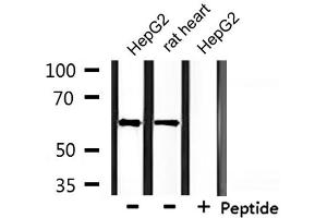 Western blot analysis of extracts from HepG2 and rat heart, using CLCC1 Antibody. (CLCC1 anticorps  (Internal Region))
