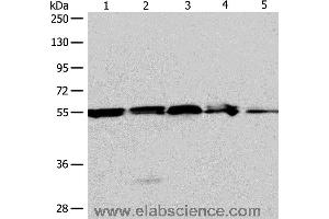 Western blot analysis of A375, 293T cell and mouse liver tissue, Jurkat cell and human fetal kidney tissue, using NAMPT Polyclonal Antibody at dilution of 1:700 (NAMPT anticorps)