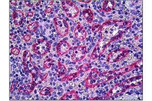 Human Spleen: Formalin-Fixed, Paraffin-Embedded (FFPE)