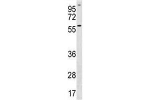 ETV5 antibody western blot analysis in A549 lysate (ETV5 anticorps  (AA 8-37))
