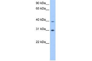 WB Suggested Anti-EIF3H Antibody Titration:  0. (EIF3H anticorps  (C-Term))