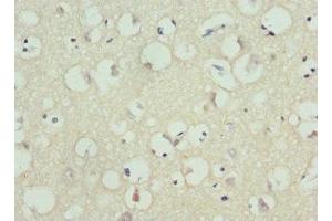 Immunohistochemistry of paraffin-embedded human brain tissue using ABIN7163991 at dilution of 1:100 (KCNH1 anticorps  (AA 840-989))