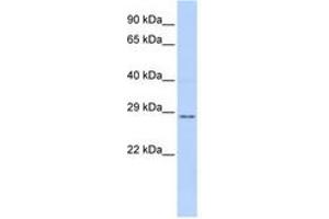 Image no. 1 for anti-Tissue Factor Pathway Inhibitor 2 (TFPI2) (AA 72-121) antibody (ABIN6741435) (TFPI2 anticorps  (AA 72-121))