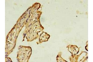 anti-RAB11B, Member RAS Oncogene Family (RAB11B) (AA 2-215) antibody