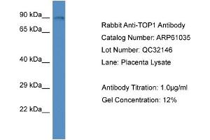 Western Blotting (WB) image for anti-Topoisomerase (DNA) I (TOP1) (N-Term) antibody (ABIN2788658) (Topoisomerase I anticorps  (N-Term))