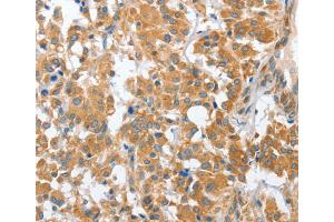 Immunohistochemistry (IHC) image for anti-Charged Multivesicular Body Protein 4B (CHMP4B) antibody (ABIN2423157) (CHMP4B anticorps)