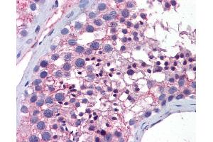 Anti-WNT10A antibody IHC of human testis.