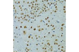 Immunohistochemistry of paraffin-embedded mouse brain using MUS81 antibody (ABIN6132372, ABIN6144202, ABIN6144203 and ABIN6222560) at dilution of 1:100 (40x lens).