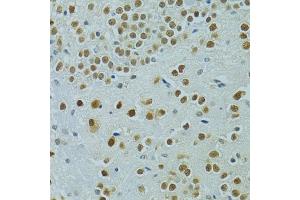 Immunohistochemistry of paraffin-embedded mouse brain using MUS81 antibody (ABIN6132372, ABIN6144202, ABIN6144203 and ABIN6222560) at dilution of 1:100 (40x lens). (MUS81 anticorps  (AA 1-350))
