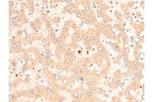 ABIN6267067 at 1/100 staining human liver tissue sections by IHC-P.
