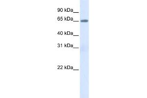 WB Suggested Anti-ALB Antibody Titration: 0. (Albumin anticorps  (N-Term))