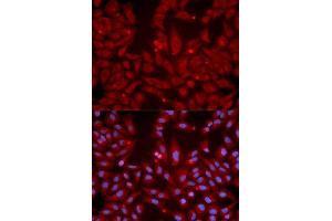 Immunofluorescence analysis of U2OS cell using GRIK2 antibody.