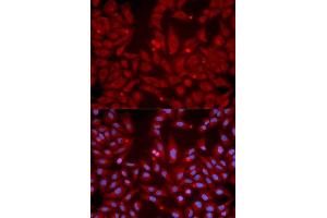 Immunofluorescence analysis of U2OS cell using GRIK2 antibody. (GRIK2 anticorps  (AA 30-300))