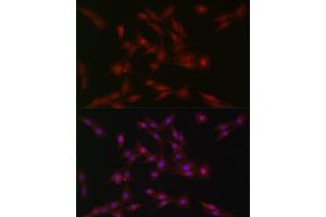 Immunofluorescence analysis of PC-12 cells using SOCS1 Rabbit pAb (ABIN6128737, ABIN6148263, ABIN6148266 and ABIN6223700) at dilution of 1:100 (40x lens). (SOCS1 anticorps  (AA 1-211))