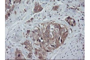 Image no. 7 for anti-Trafficking Protein Particle Complex 4 (TRAPPC4) antibody (ABIN1501263)