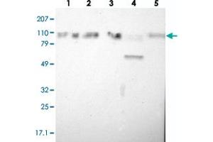Western blot analysis of Lane 1: RT-4, Lane 2: EFO-21, Lane 3: A-431, Lane 4: Liver, Lane 5: Tonsil with SMEK2 polyclonal antibody  at 1:250-1:500 dilution. (SMEK2 anticorps)