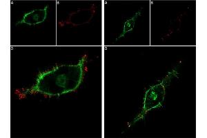 Live cell imaging of recombinant human GDNF-Biotin protein in live intact human SH-SY5Y cells. (GDNF Protein (Biotin))