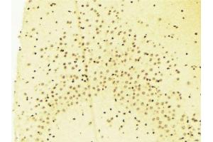 ABIN6269019 at 1/100 staining Mouse brain tissue by IHC-P.