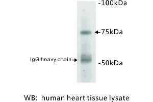 Image no. 1 for anti-Bone Morphogenetic Protein Receptor, Type II (serine/threonine Kinase) (BMPR2) antibody (ABIN1112849)