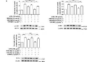 Effects of the 20(R/S)-Rg3 stereoisomers on cell cycle progression and cell cycle related-protein expression in AGE-stimulated VSMCs. (PCNA anticorps  (AA 201-261))