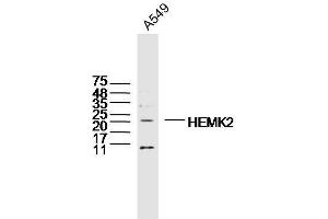 A549 lysates probed with HEMK2 Polyclonal Antibody, Unconjugated  at 1:300 dilution and 4˚C overnight incubation. (N6AMT1 anticorps  (AA 1-100))
