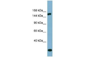WB Suggested Anti-EPRS Antibody Titration:  0. (EPRS anticorps  (Middle Region))
